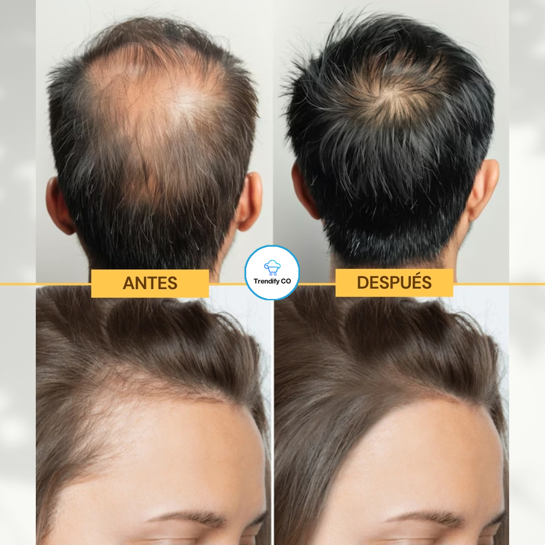 Aceite PURE para Crecimiento Capilar Y Brillo